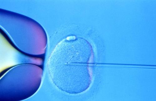 宁波合法助孕套餐-宫颈性不孕有哪些具体检查？