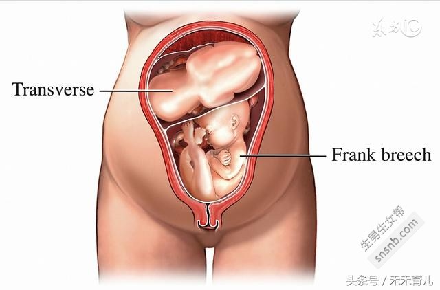 怀孕双胞胎的早期症状，准妈妈还没做B超的时候可以看一下
