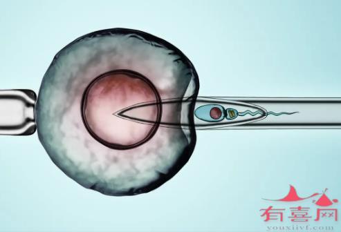 卵巢早衰的试管婴儿的成功率是多少？